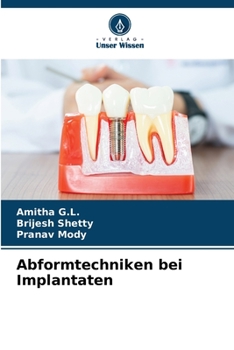 Paperback Abformtechniken bei Implantaten [German] Book