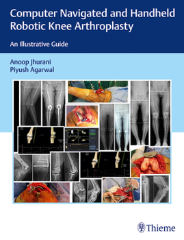 Hardcover Computer Navigated and Handheld Robotic Knee Arthroplasty: An Illustrative Guide Book