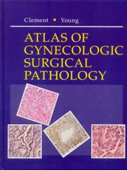 Hardcover Atlas of Gynecologic Surgical Pathology: A Volume in the Atlases in Diagnostic Surgical Pathology Series Book