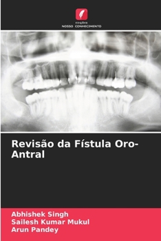 Paperback Revisão da Fístula Oro-Antral [Portuguese] Book