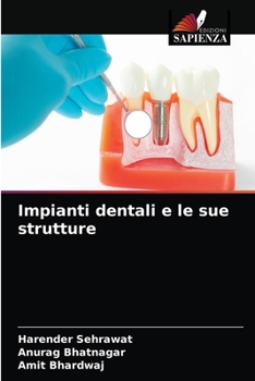 Paperback Impianti dentali e le sue strutture [Italian] Book