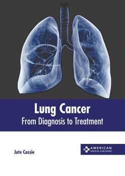 Hardcover Lung Cancer: From Diagnosis to Treatment Book