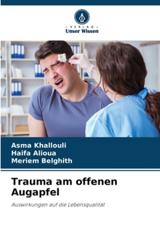 Paperback Trauma am offenen Augapfel [German] Book