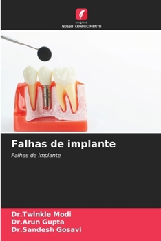 Paperback Falhas de implante [Portuguese] Book