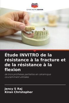 Étude INVITRO de la résistance à la fracture et de la résistance à la flexion (French Edition)