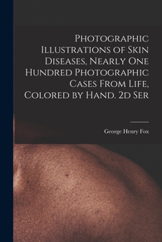 Paperback Photographic Illustrations of Skin Diseases, Nearly One Hundred Photographic Cases From Life, Colored by Hand. 2d Ser Book