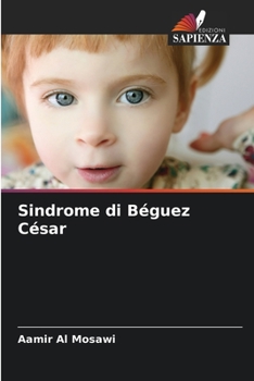 Paperback Sindrome di Béguez César [Italian] Book