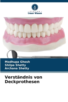 Paperback Verständnis von Deckprothesen [German] Book