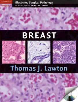 Hardcover Illustrated Surgical Pathology of the Breast [With CDROM] Book