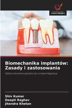 Biomechanika implantów: Zasady i zastosowania (Polish Edition)