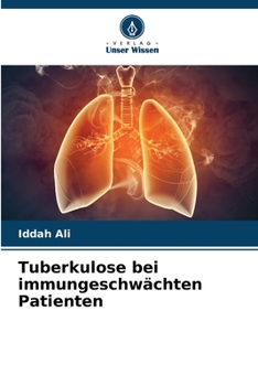 Paperback Tuberkulose bei immungeschwächten Patienten [German] Book