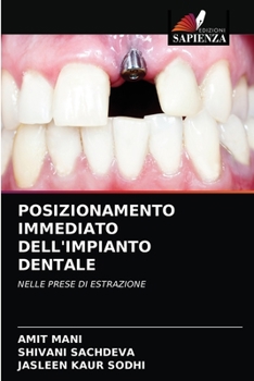 Paperback Posizionamento Immediato Dell'impianto Dentale [Italian] Book