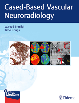 Paperback Imaging in Neurovascular Disease: A Case-Based Approach Book