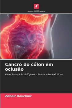 Cancro do cólon em oclusão (Portuguese Edition)