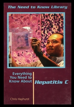 Paperback Hepatitis C Book