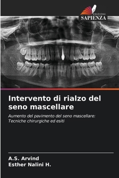 Paperback Intervento di rialzo del seno mascellare [Italian] Book