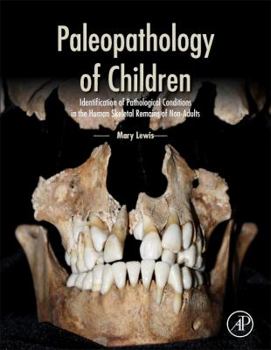 Hardcover Paleopathology of Children: Identification of Pathological Conditions in the Human Skeletal Remains of Non-Adults Book