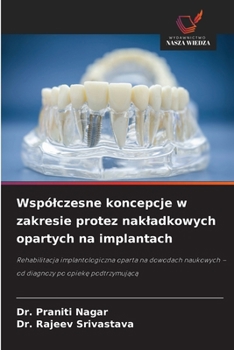 Wspólczesne koncepcje w zakresie protez nakladkowych opartych na implantach (Polish Edition)