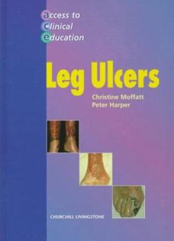 Hardcover Leg Ulcers Book