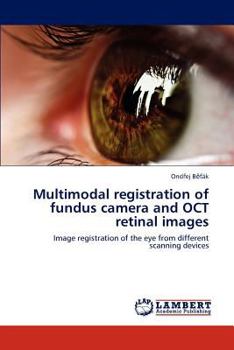 Paperback Multimodal registration of fundus camera and OCT retinal images Book