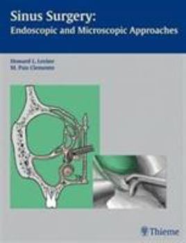 Paperback Sinus Surgery: Endoscopic and Microscopic Approaches Book