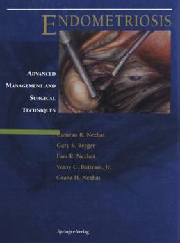Hardcover Endometriosis: Advanced Management and Surgical Techniques Book