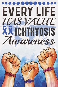 Paperback Every Life Has Value Ichthyosis Awareness: College Ruled Ichthyosis Awareness Journal, Diary, Notebook 6 x 9 inches with 100 Pages Book