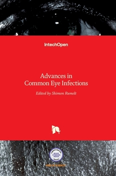 Hardcover Advances in Common Eye Infections Book