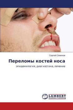 Paperback Perelomy Kostey Nosa [Russian] Book