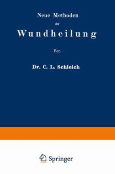 Paperback Neue Methoden Der Wundheilung: Ihre Bedingungen Und Vereinfachung Für Die PRAXIS [German] Book