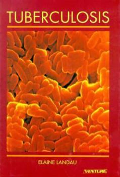 Library Binding Tuberculosis Book