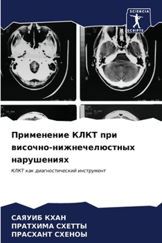 Paperback Применение КЛКТ при висо [Russian] Book