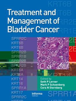 Hardcover Treatment and Management of Bladder Cancer [With CDROM] Book