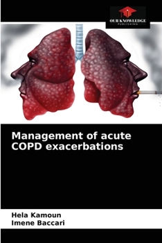 Paperback Management of acute COPD exacerbations Book