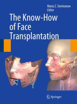 Hardcover The Know-How of Face Transplantation Book