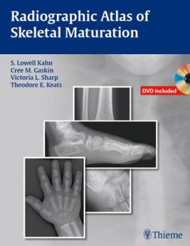 Hardcover Radiographic Atlas of Skeletal Maturation Book