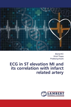 Paperback ECG in ST elevation MI and its correlation with infarct related artery Book