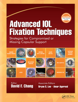 Hardcover Advanced IOL Fixation Techniques: Strategies for Compromised or Missing Capsular Support Book