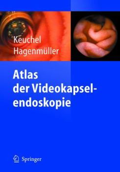 Atlas der Videokapselendoskopie (German Edition)