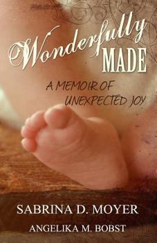 Paperback Wonderfully Made: A Memoir of Unexpected Joy Book