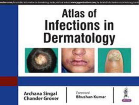 Paperback Atlas of Infections in Dermatology Book