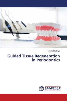Paperback Guided Tissue Regeneration in Periodontics Book