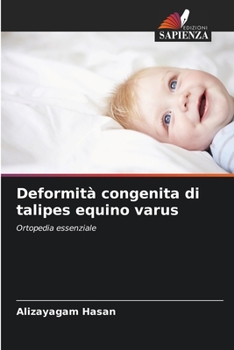 Paperback Deformità congenita di talipes equino varus [Italian] Book