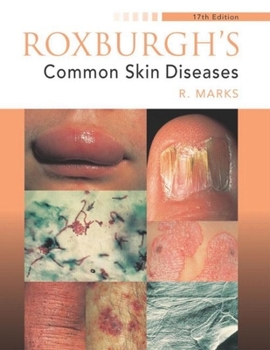 Paperback Roxburgh's Common Skin Diseases Book