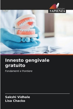 Innesto gengivale gratuito (Italian Edition)