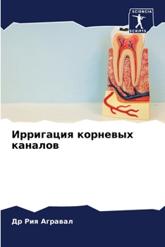 Paperback Ирригация корневых кана& [Russian] Book