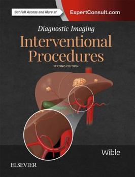 Hardcover Diagnostic Imaging: Interventional Procedures Book