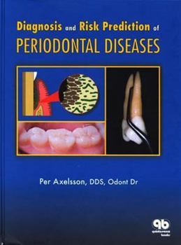 Hardcover Diagnosis and Risk Prevention of Periodontal Diseases Book