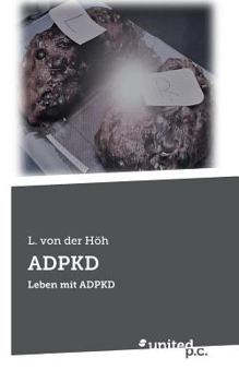 Paperback Adpkd: Leben mit ADPKD [German] Book