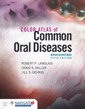 Paperback Color Atlas of Common Oral Diseases, Enhanced Edition Book